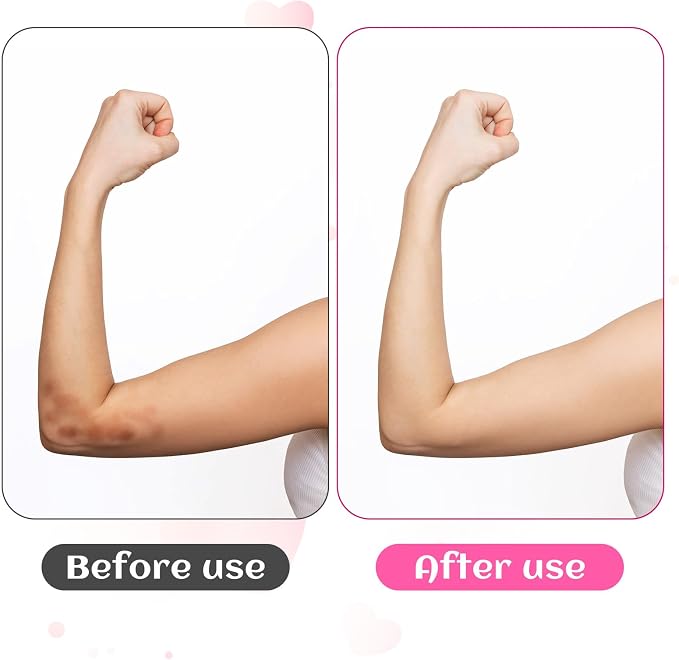 Piriuuo 2 Pairs/4 Pcs Elbow Moisturizing Sleeve, Elastic Gel Elbow Pads for Women, Soft Sleeve Elbows Protector for Spa Moisturizing Dry Cracked Skin Care (Pink)