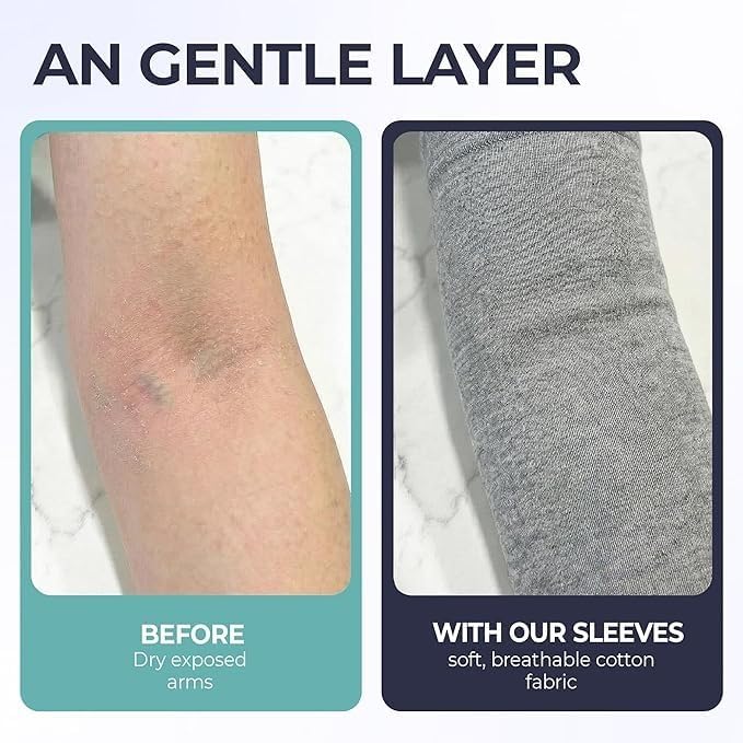 100% Organic Cotton Eczema Arm Sleeves - Anti Scratch, Secure Fit, Washable, Unisex, 1 Pair