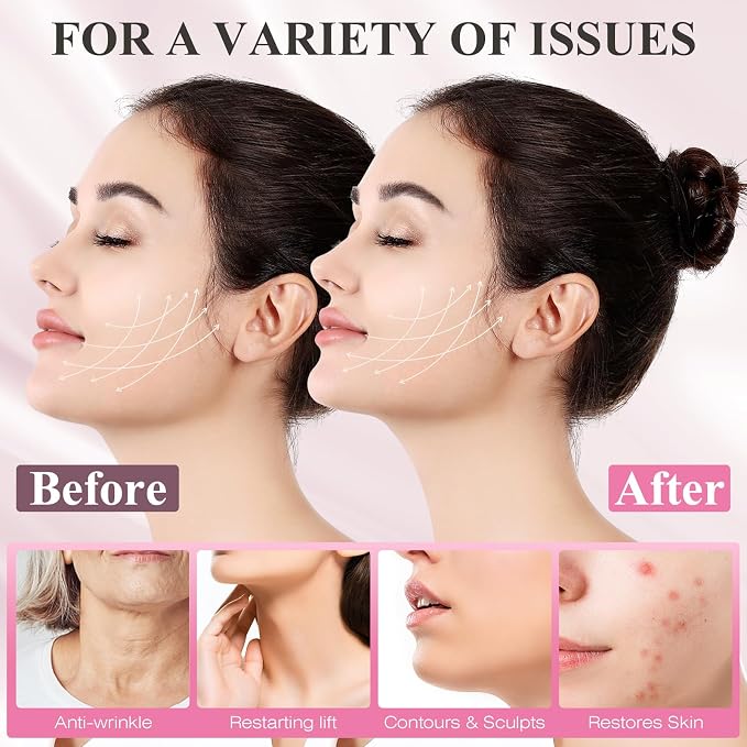 Juskaa Reusable V Line Lifting Mask with Chin Strap for Sleeping,Face Lift Prevent Sagging, Jaw Exerciser,Light pink,M,2pcs