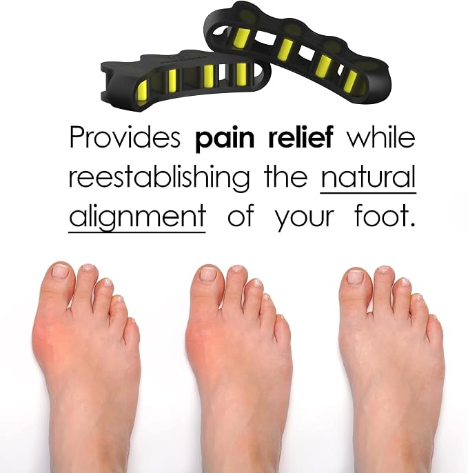 VYCE PrimalStep Toe Separators, Spreaders, Spacers, 2 Pairs S/M, Large | Straightener to Correct Toes for Men and Women, Bunion Corrector, Plantar Fasciitis and Athletic Mobility