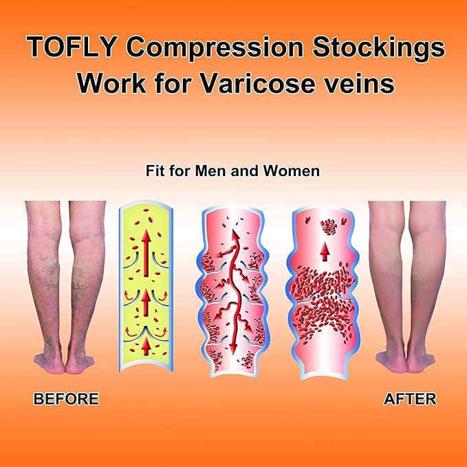 TOFLY Calf Compression Sleeve 20-30mmHg 1 Pair Footless For Men & Women | Footless Compression Socks For Leg Support, Shin Splint, Pain Relief, Swelling, Varicose Veins, Maternity, Nursing, & Travel