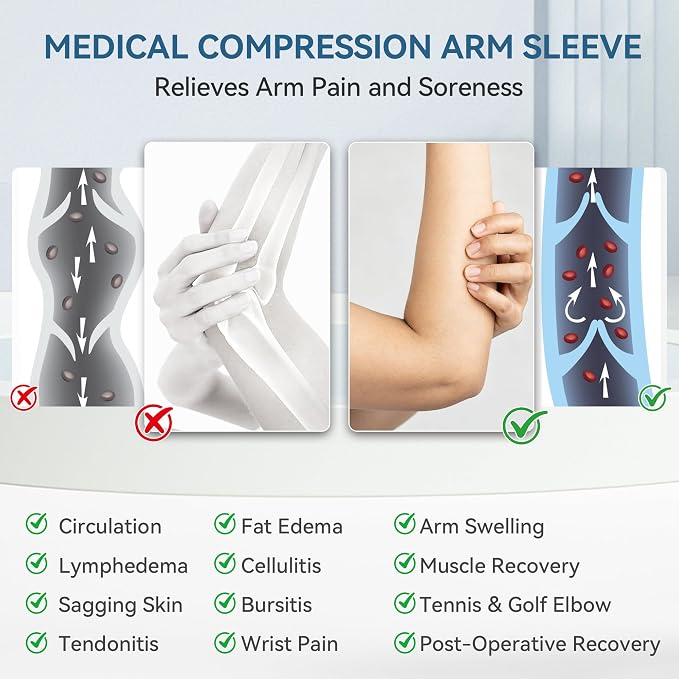 1 Pair Medical Compression Arm Sleeves for Women&Men,No Palm Cover | Full Arm Support,Silicone Anti-Slip Dots,20-30 mmHg Graduated Compression,Lymphedema,Arthritis,Bursitis,Post-Surgery