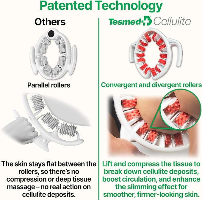 TESMED Cellulite Manual Massager Roller for Thighs and Buttocks | Made in Italy and patented, with converging and diverging roller technology for targeted anti-cellulite massage.